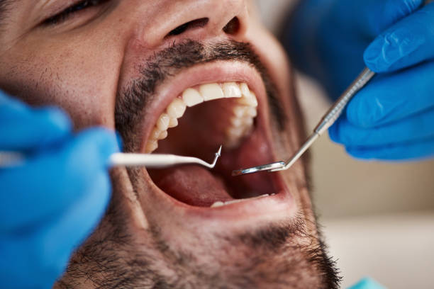 Best Emergency Root Canal Therapy in Mills River, NC
